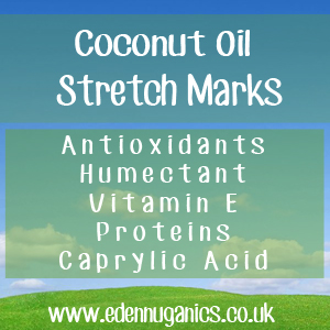 Coconut Oil for Stretch Marks
